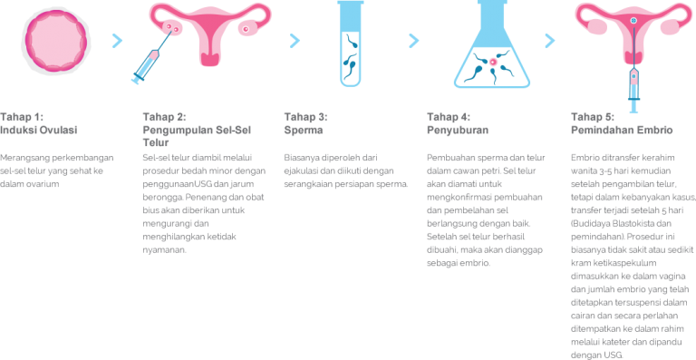 Fertilisasi In Vitro Ivf Alpha Ivf Fertility Center Malaysia